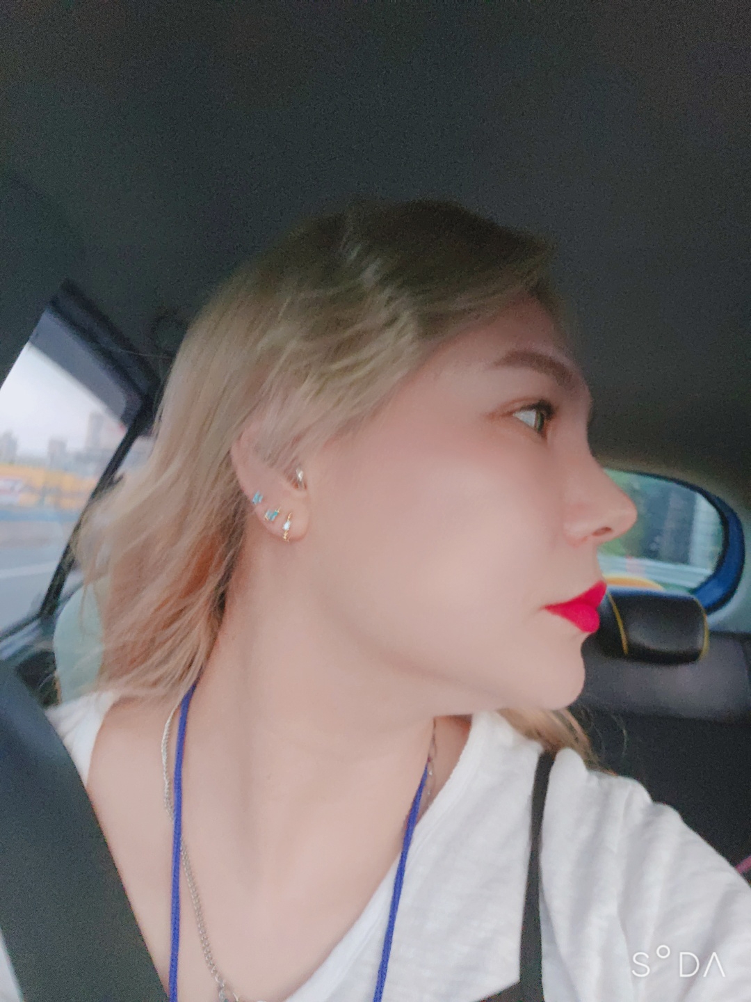 수술후기이미지