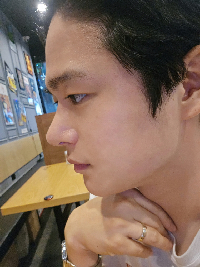 수술후기이미지