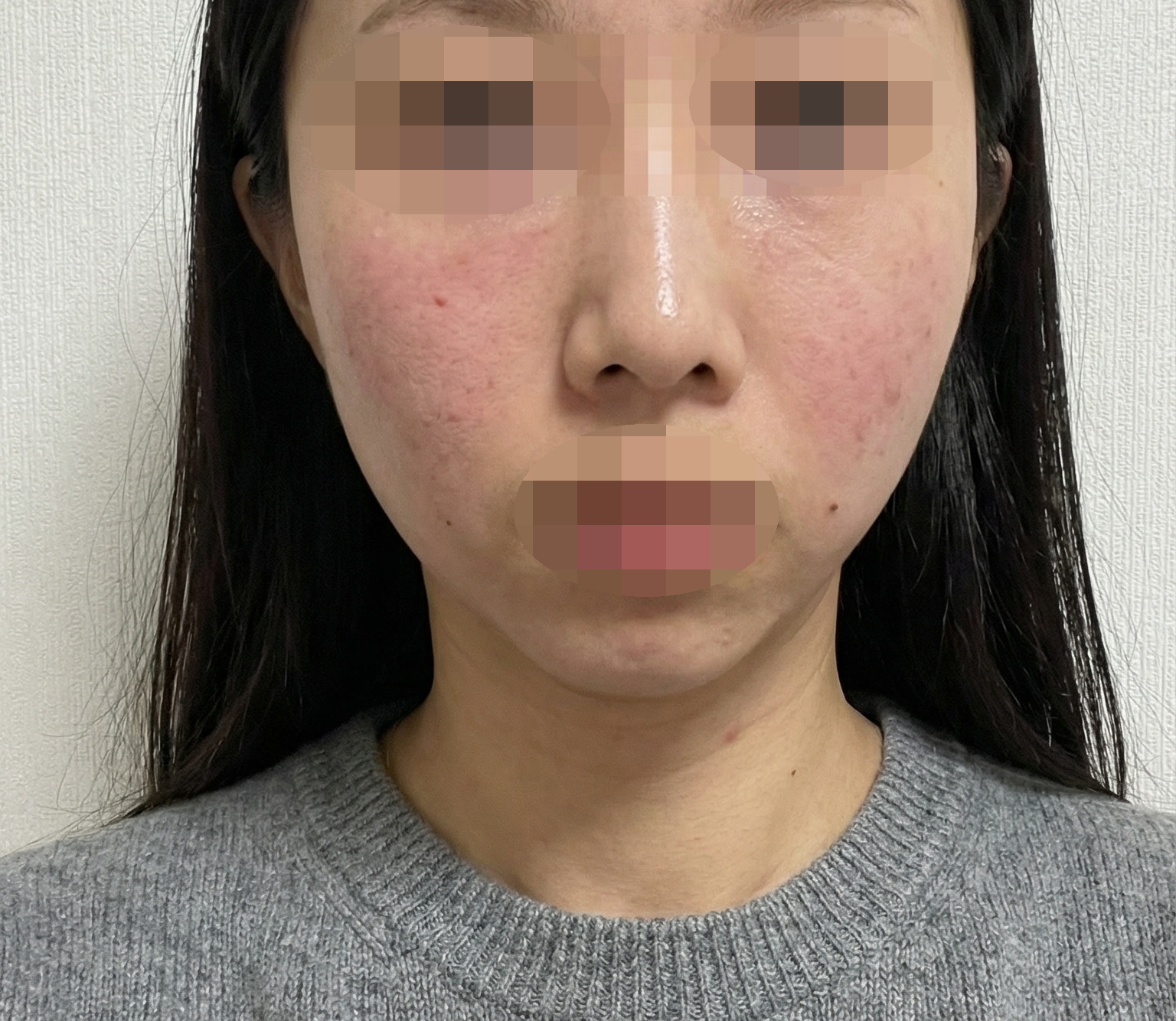 수술후기이미지