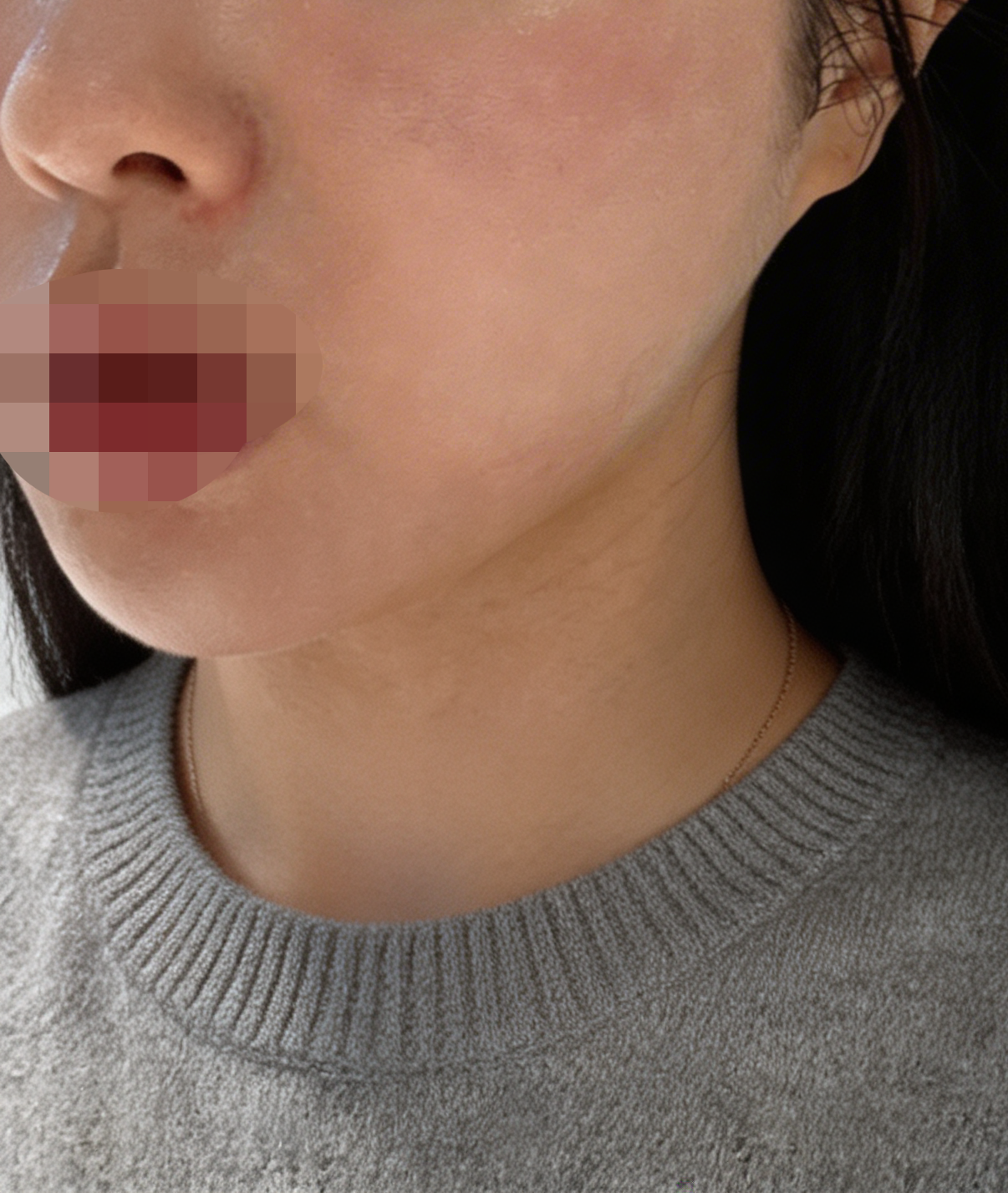 수술후기이미지