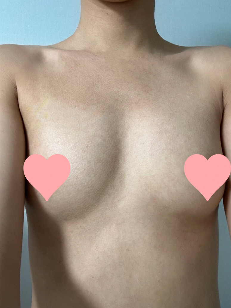 수술후기이미지