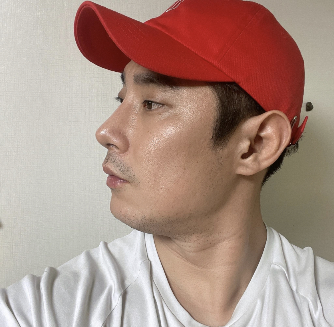 수술후기이미지