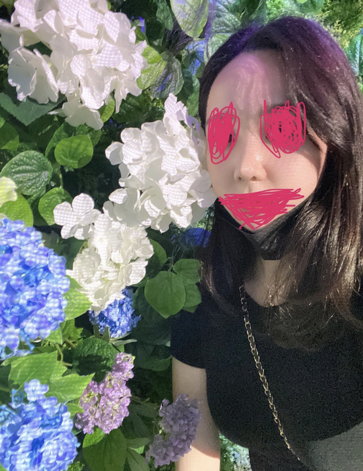 수술후기이미지