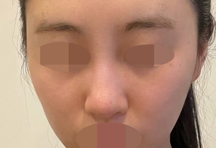 수술후기이미지