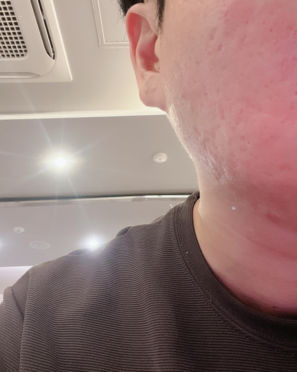 수술후기이미지