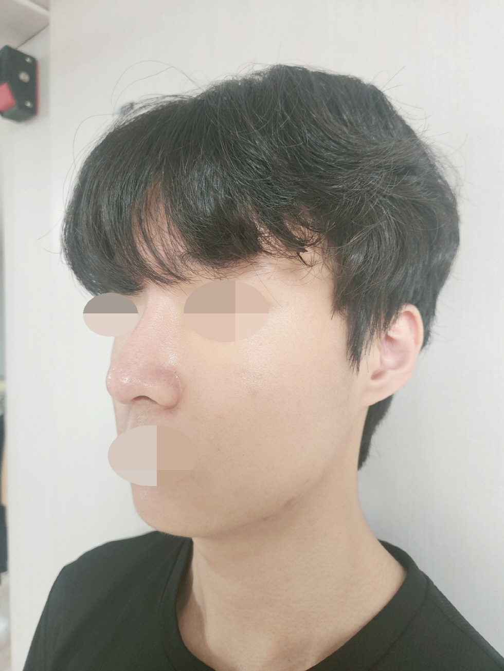 수술후기이미지