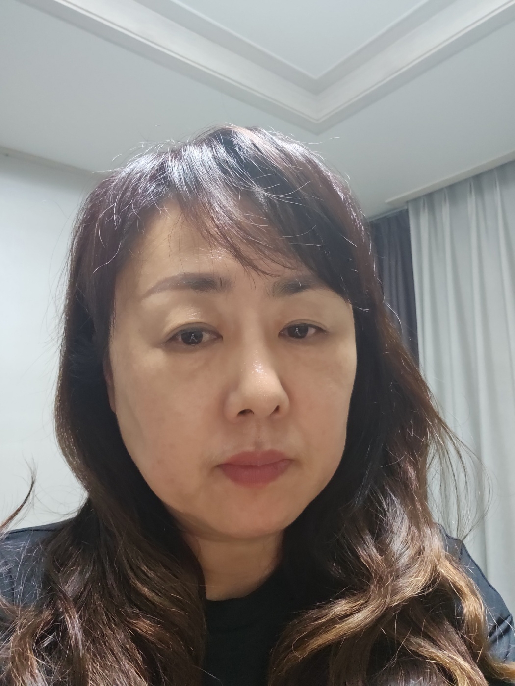 수술후기이미지