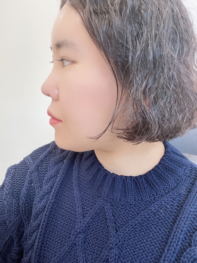 수술후기이미지