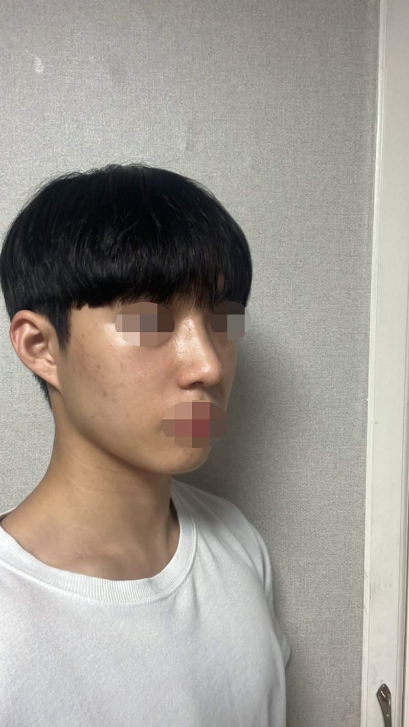 수술후기이미지