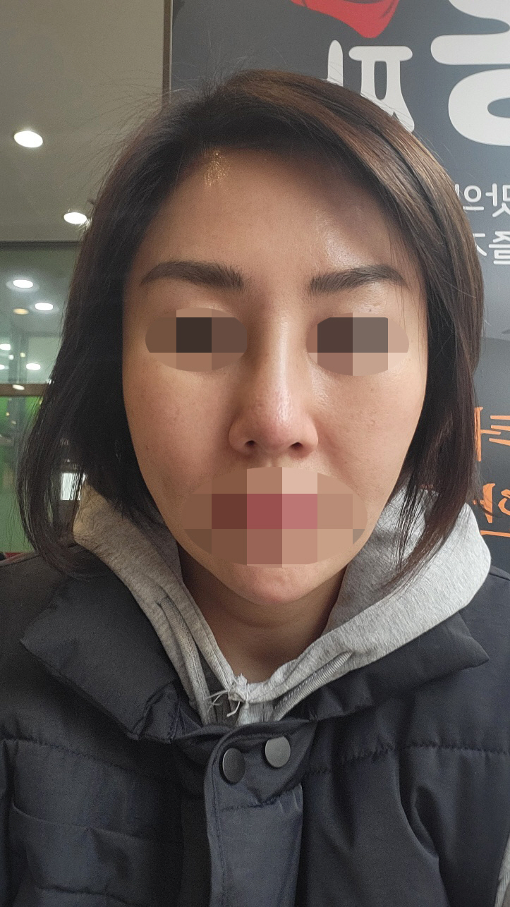 수술후기이미지