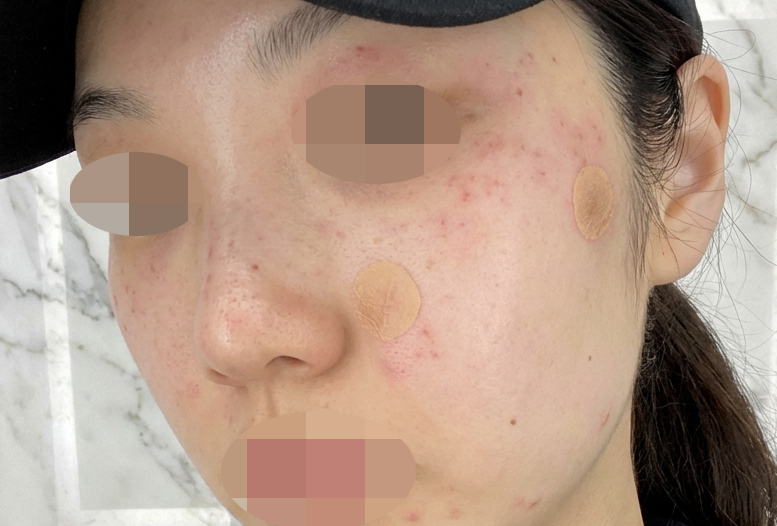 수술후기이미지