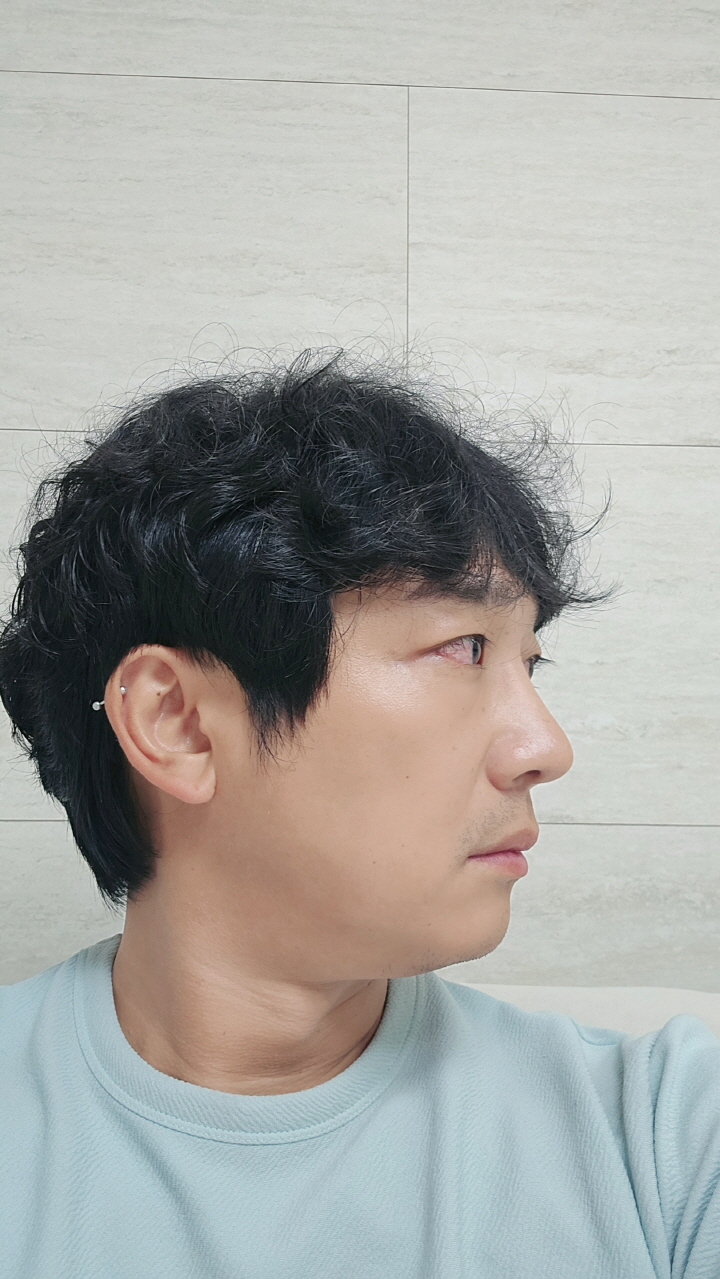 수술후기이미지