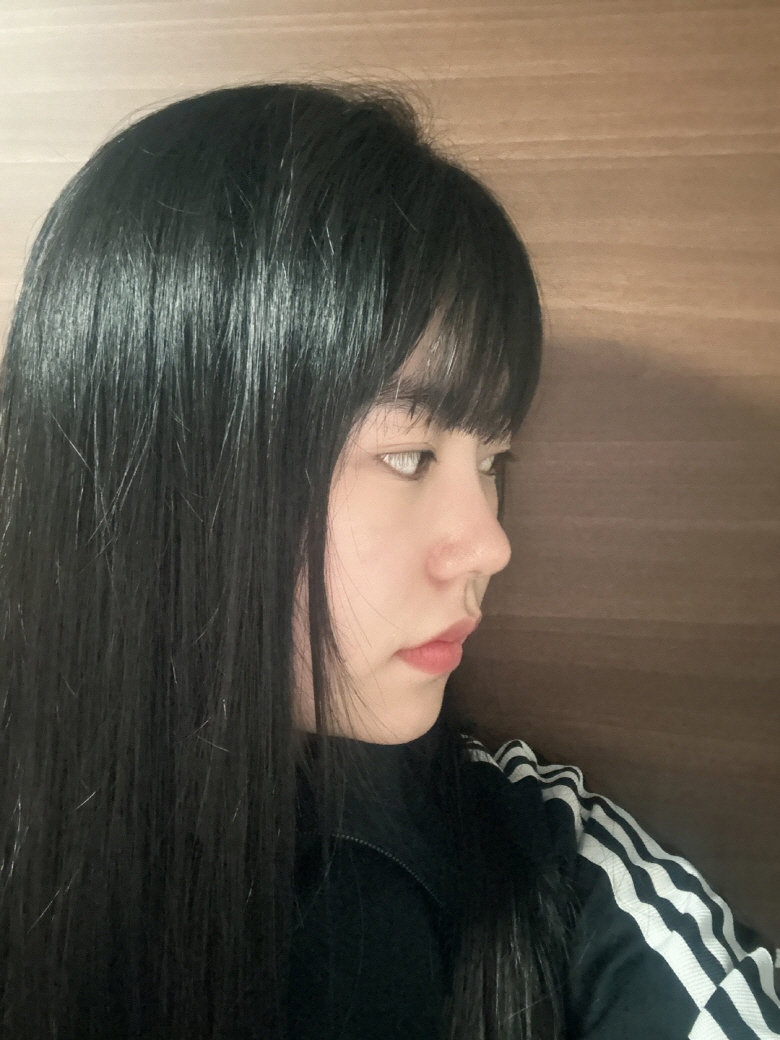 수술후기이미지