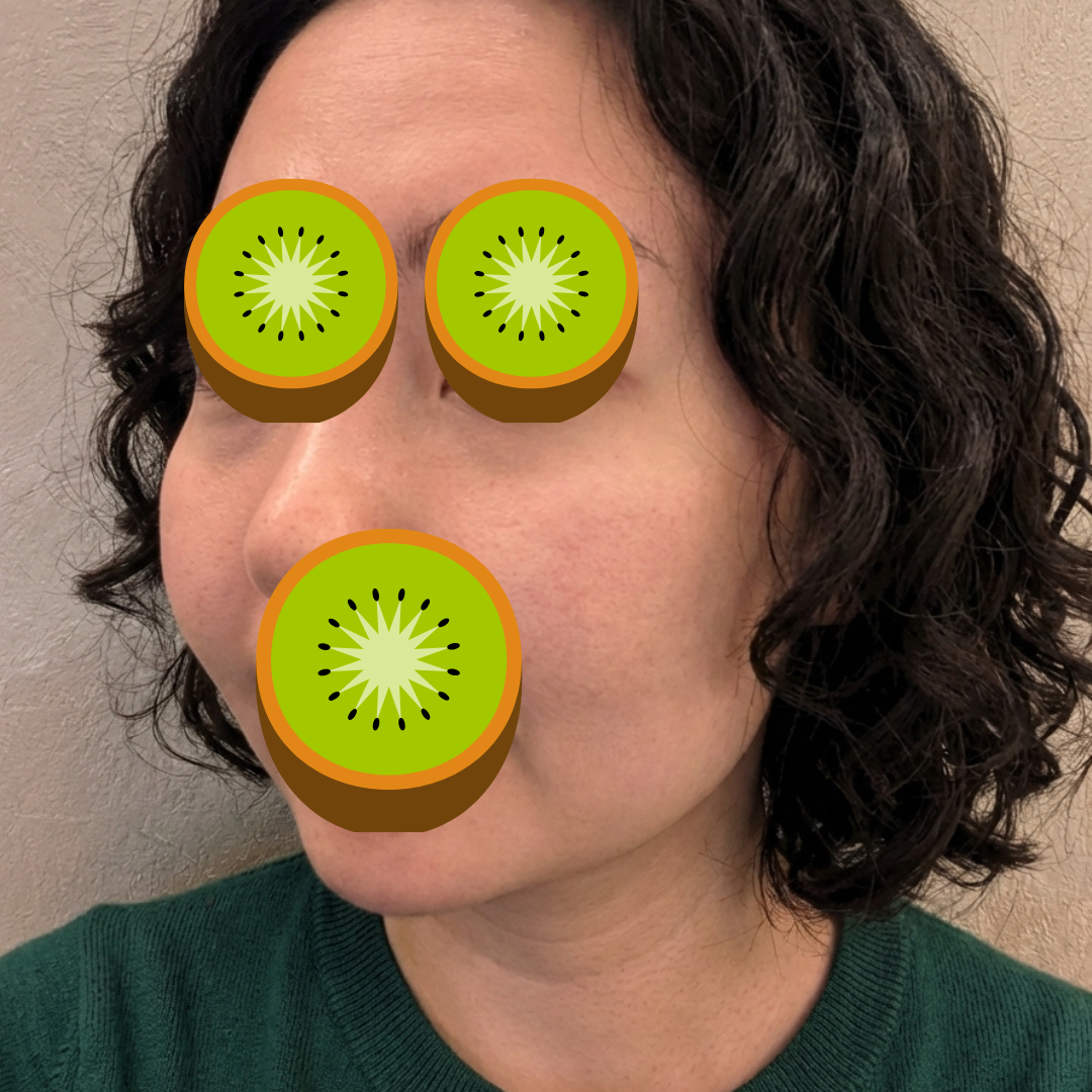 수술후기이미지