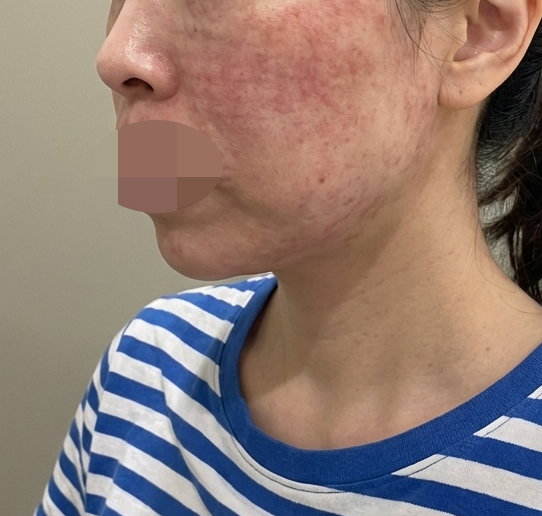 수술후기이미지