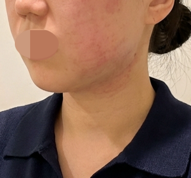 수술후기이미지