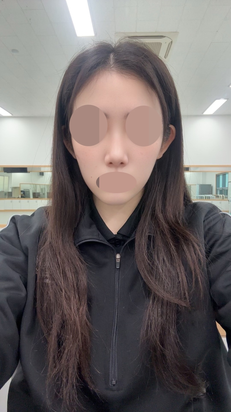 수술후기이미지