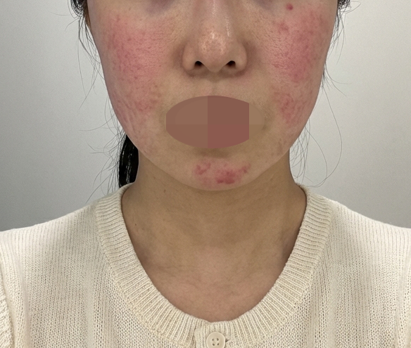 수술후기이미지