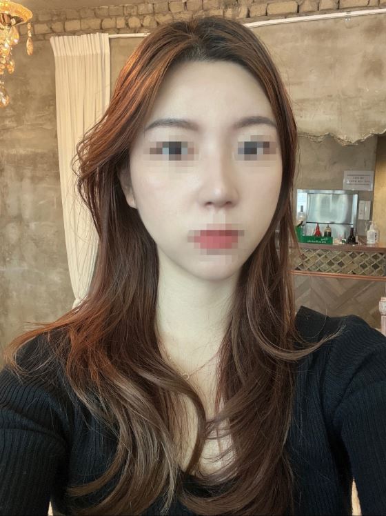 수술후기이미지