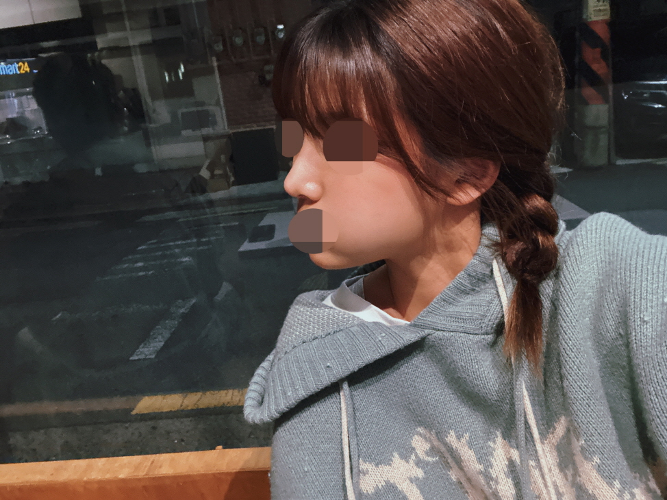 수술후기이미지