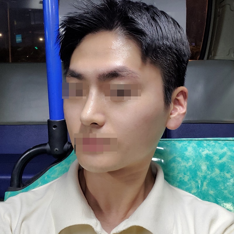 수술후기이미지