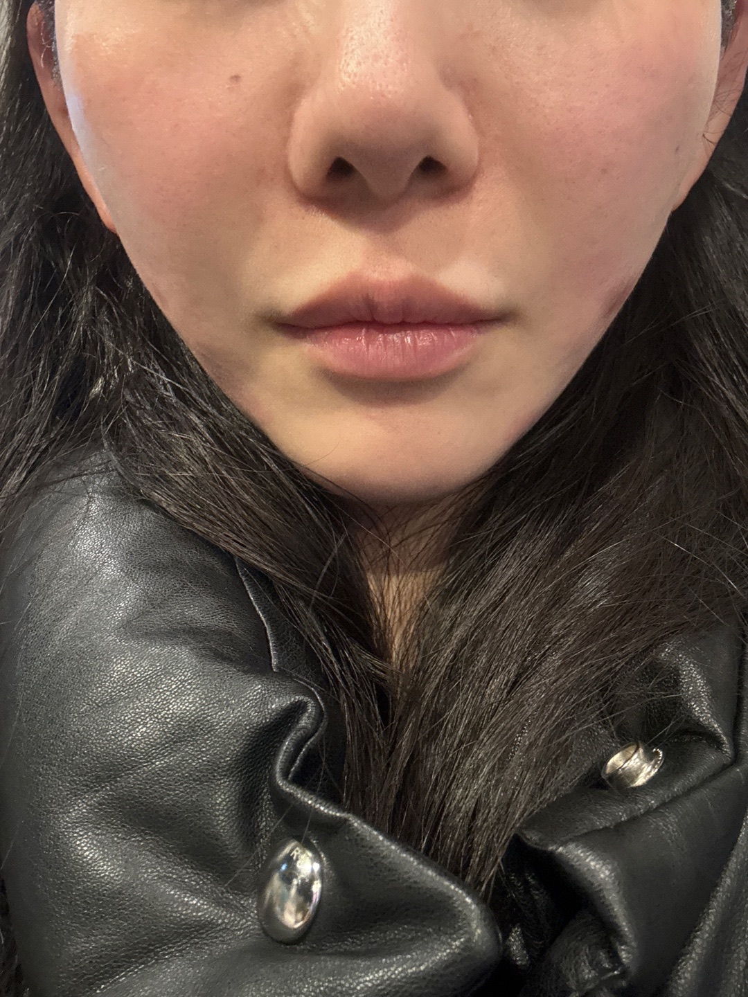 수술후기이미지