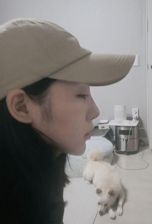 수술후기이미지