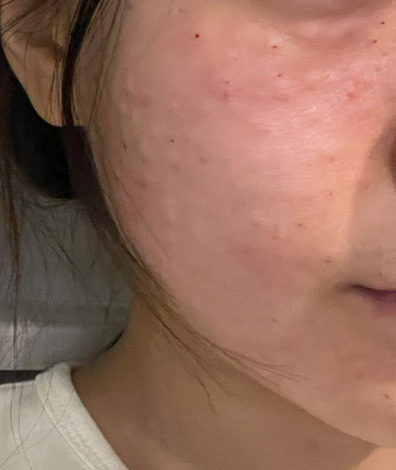 수술후기이미지