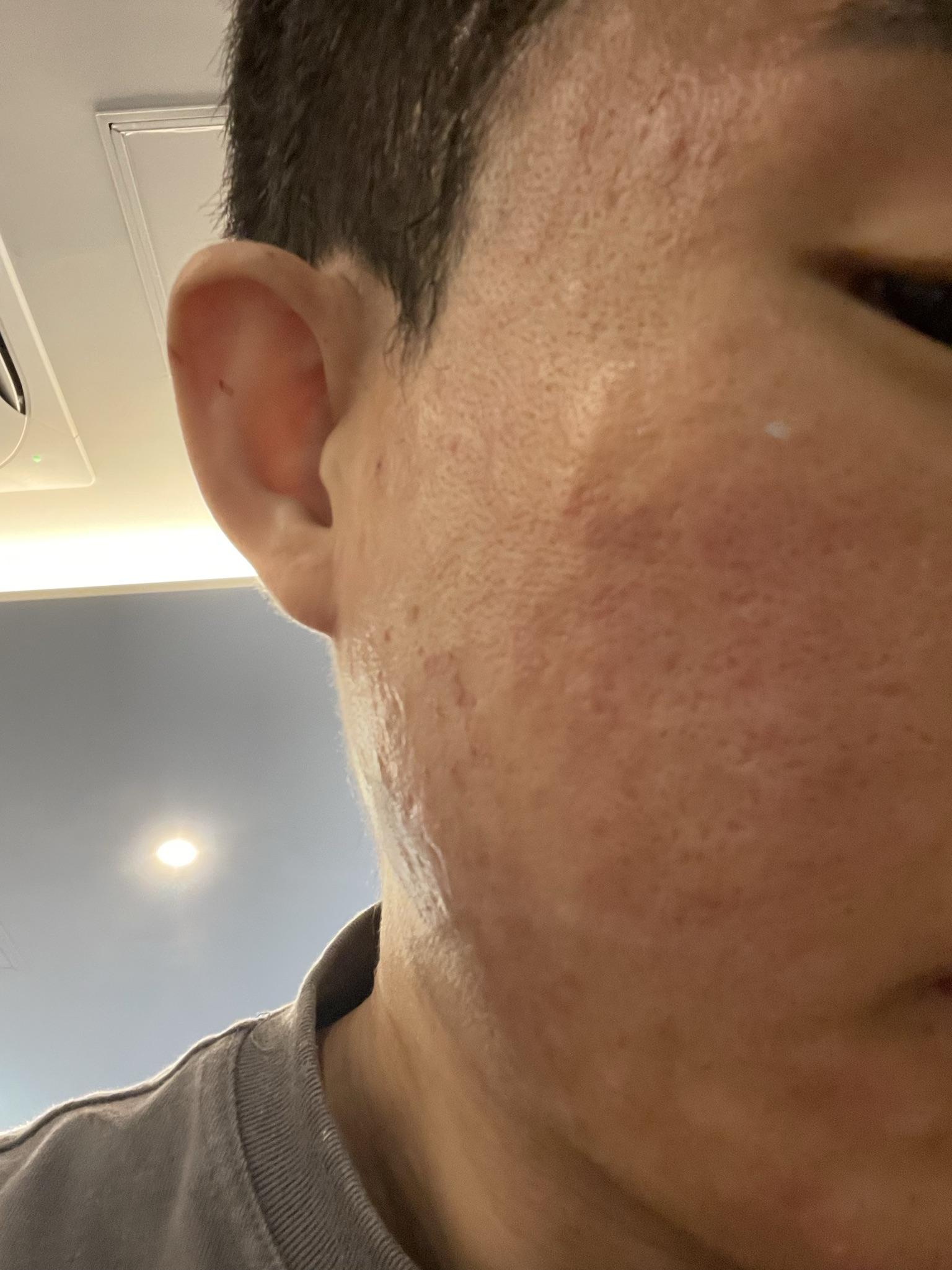 수술후기이미지