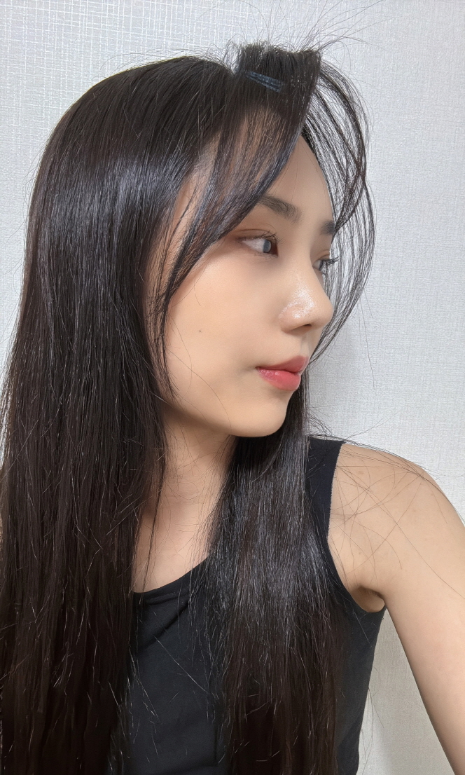 수술후기이미지