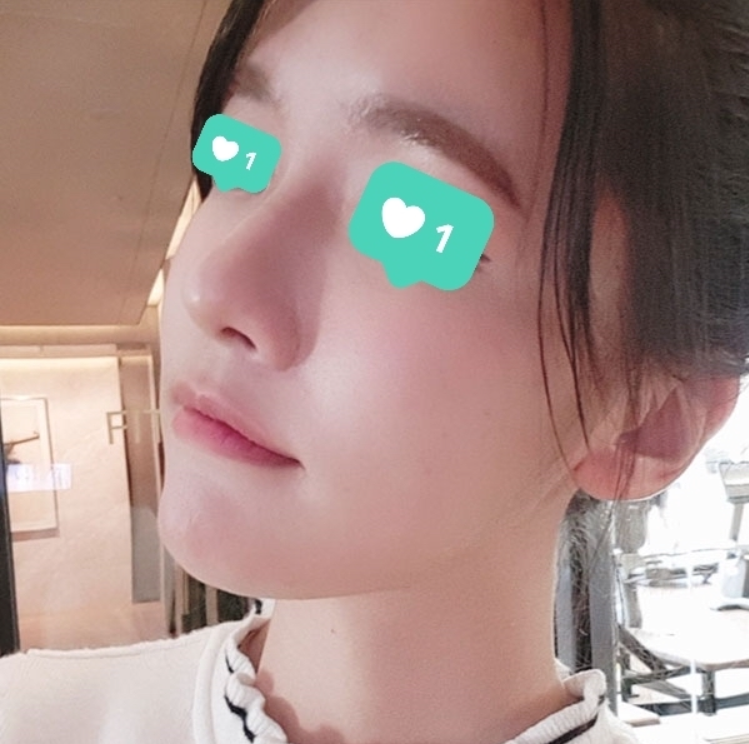 수술후기이미지