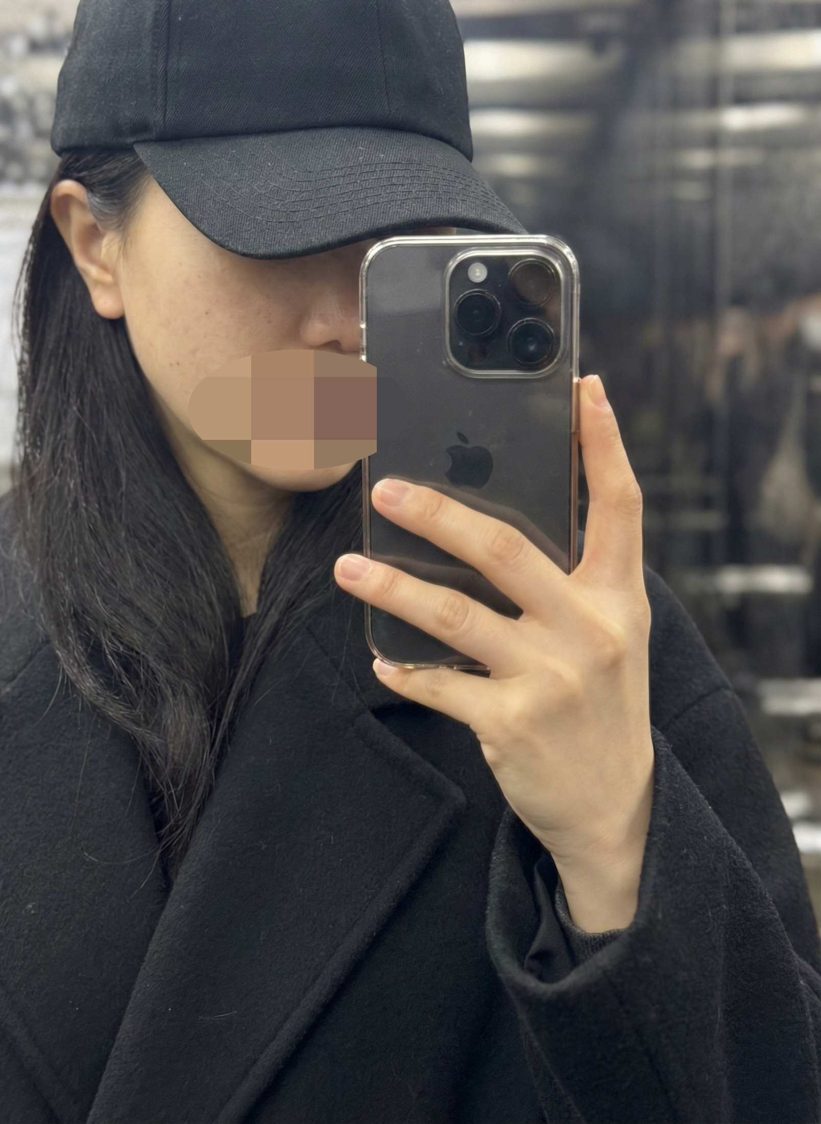 수술후기이미지