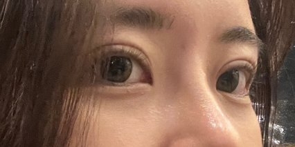 수술후기이미지