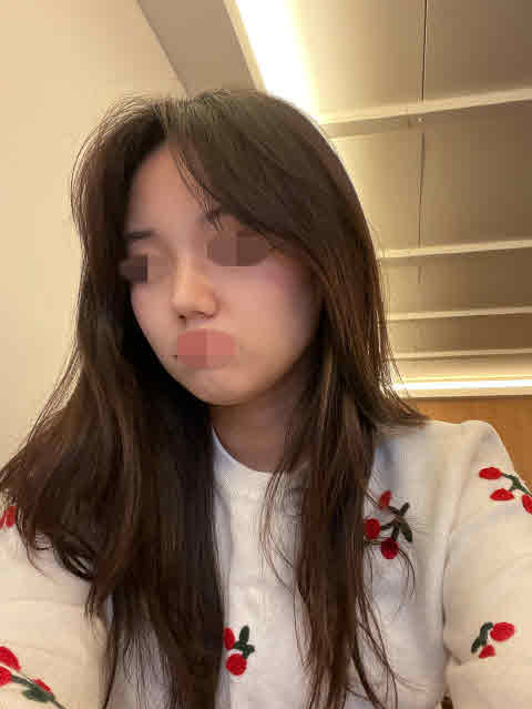 수술후기이미지