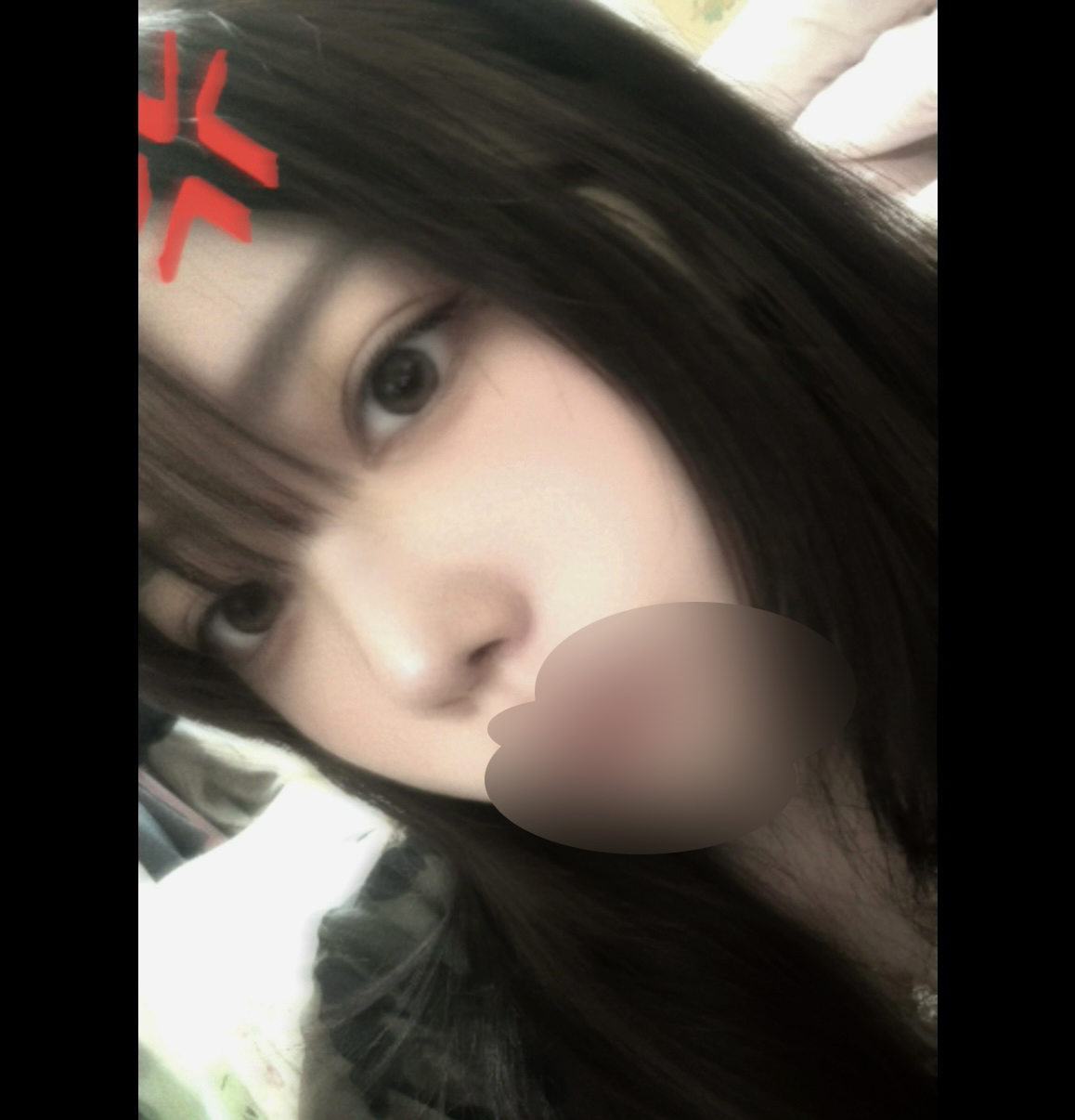 수술후기이미지