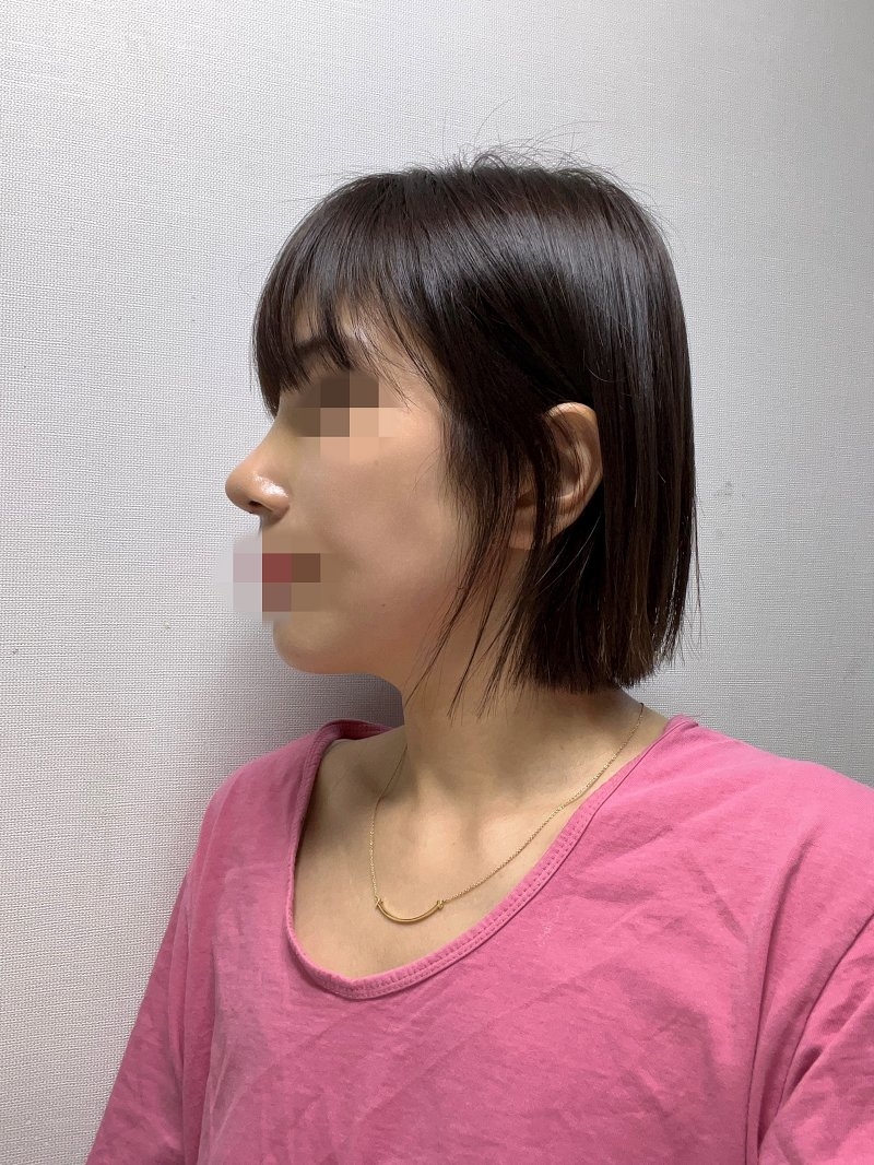 수술후기이미지