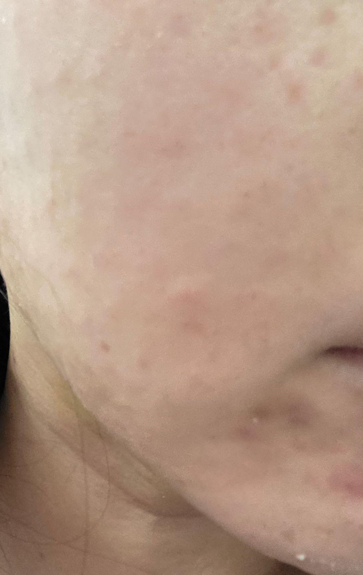 수술후기이미지