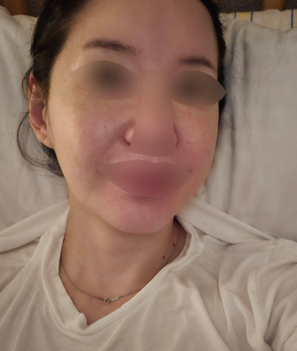 수술후기이미지