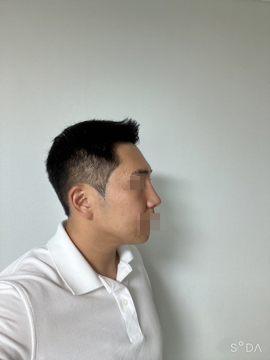 수술후기이미지