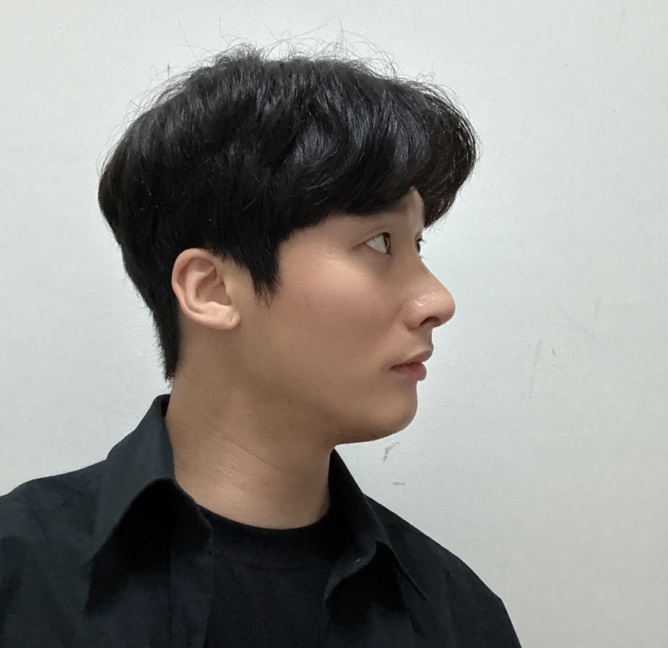 수술후기이미지