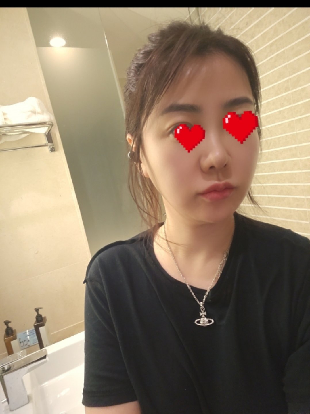 수술후기이미지