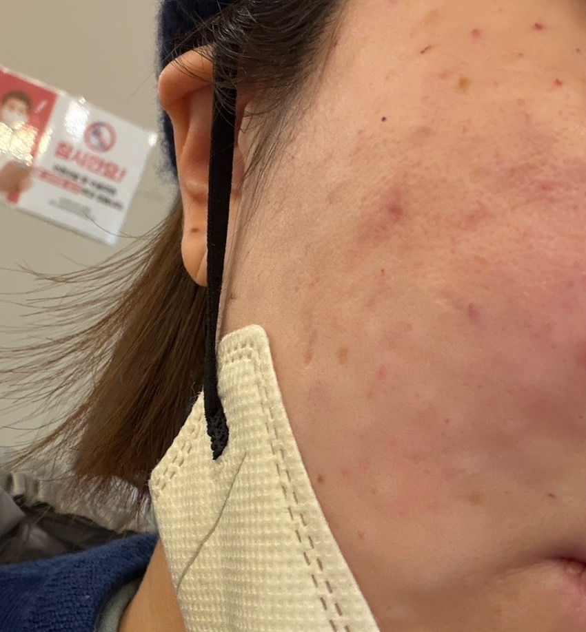 수술후기이미지