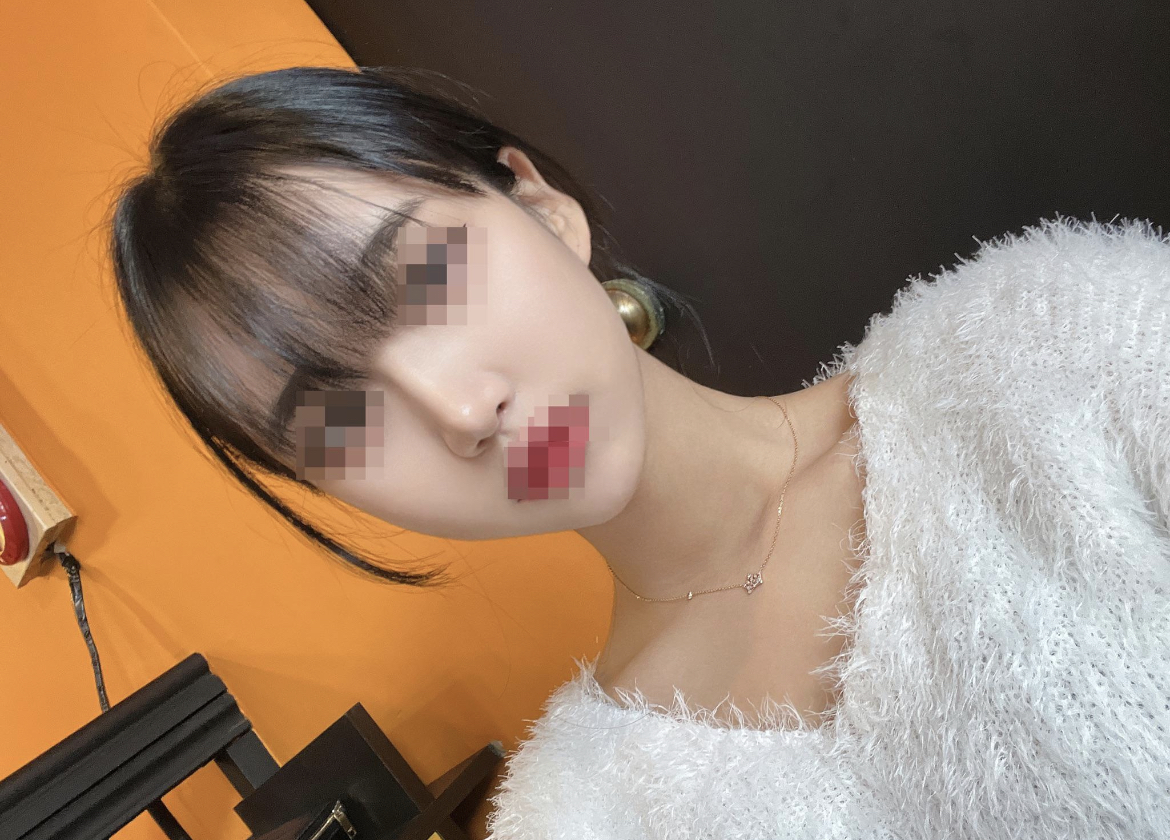 수술후기이미지