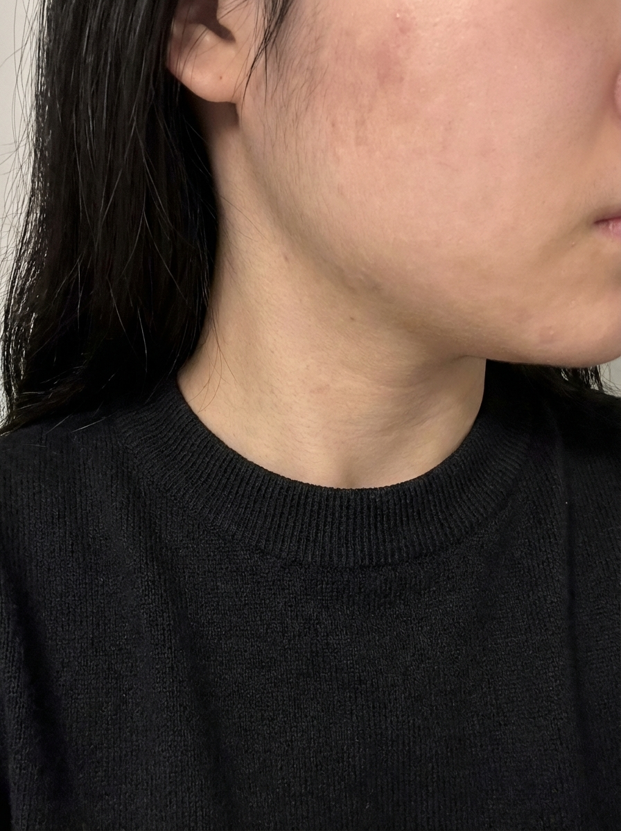 수술후기이미지