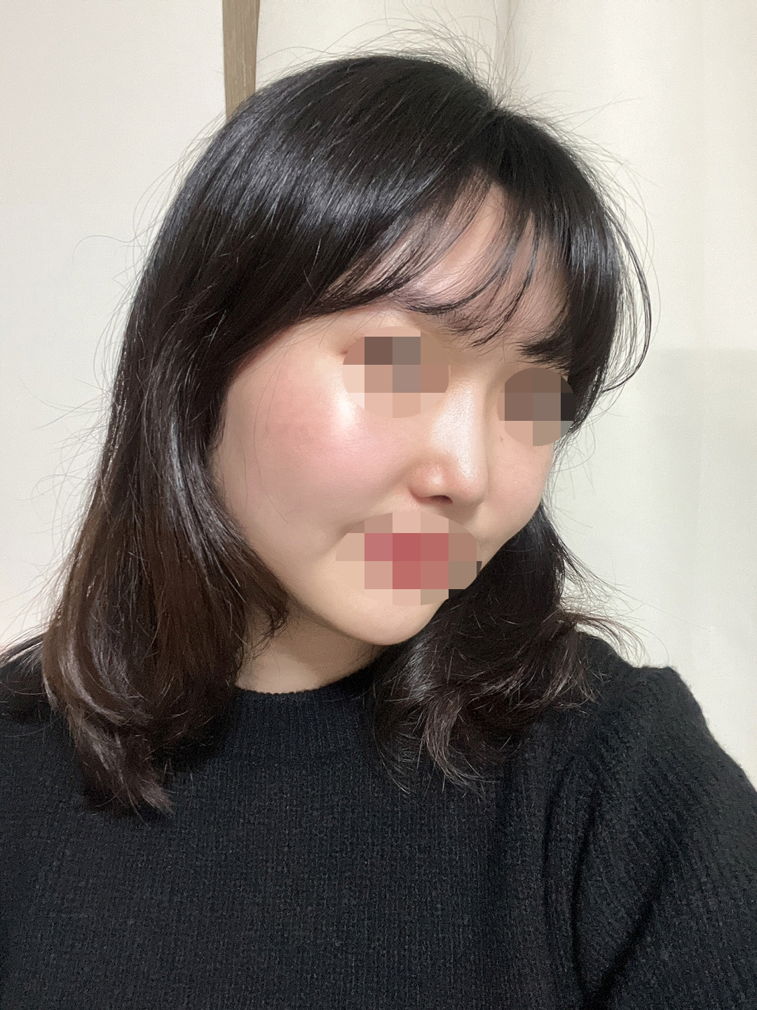 수술후기이미지