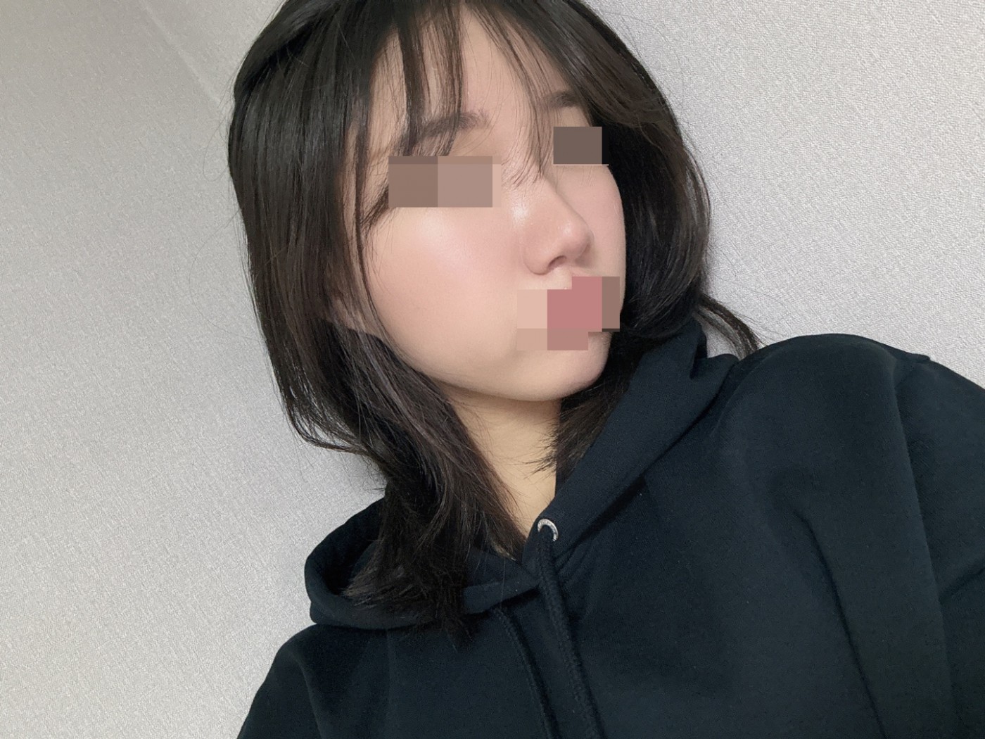 수술후기이미지