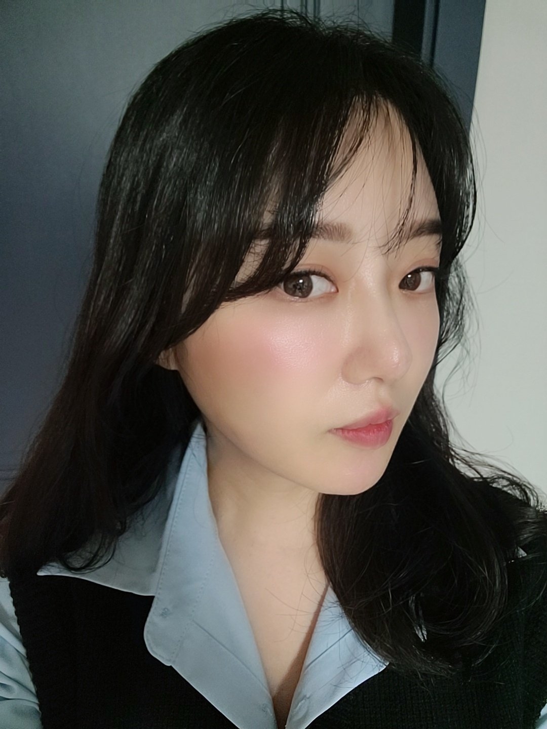 수술후기이미지