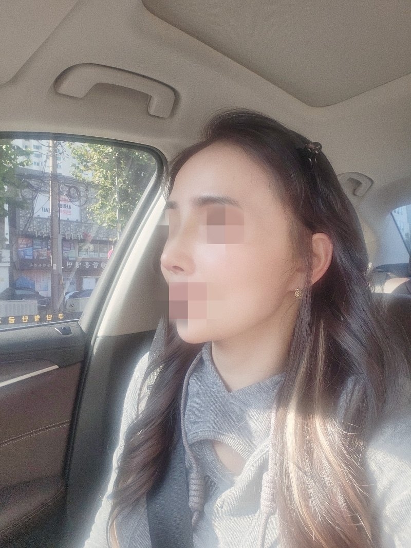 수술후기이미지