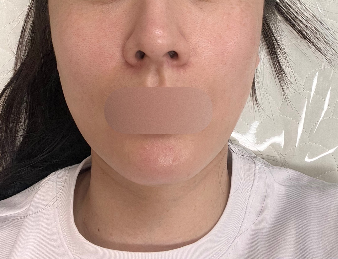 수술후기이미지