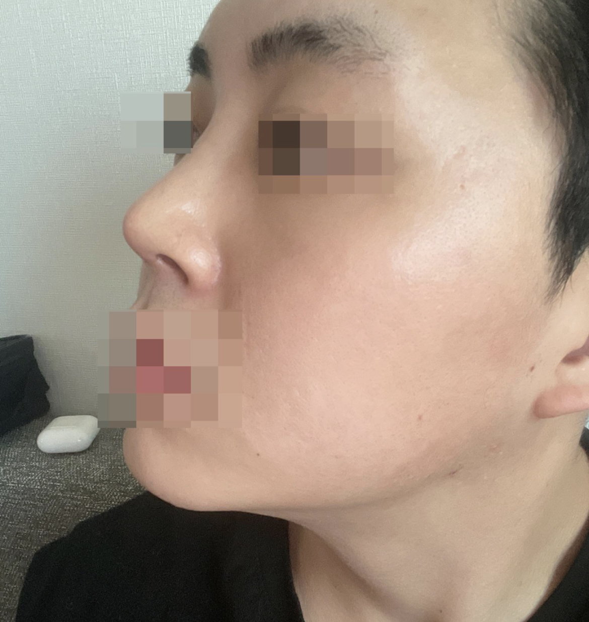 수술후기이미지